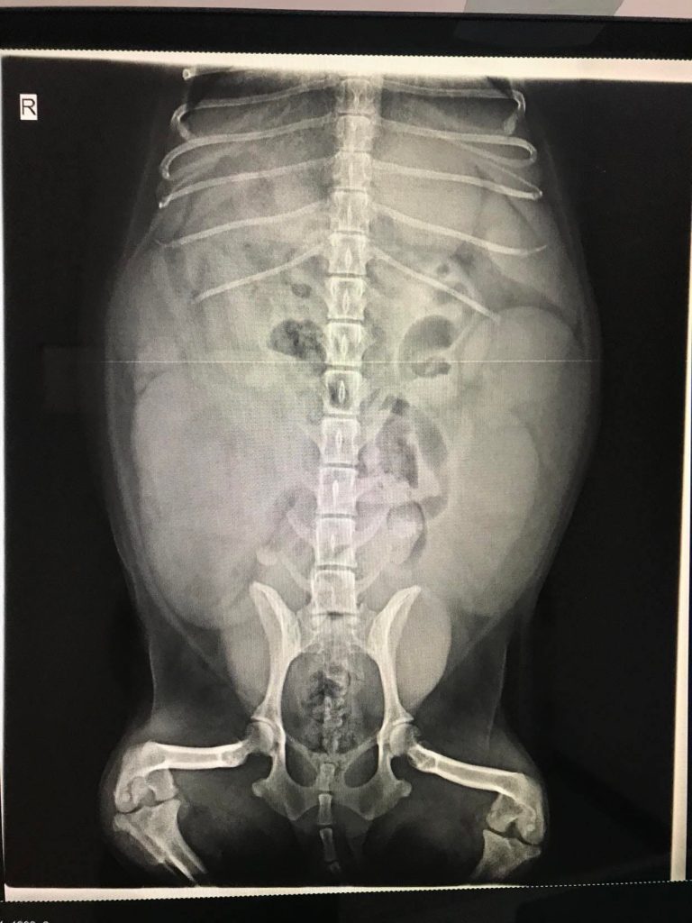 X光下膨大的子宮